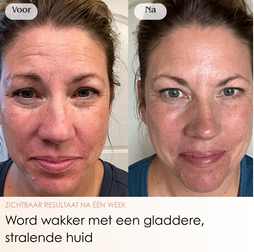 NMBDD ™ Glass Skin - Collageen Masker