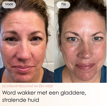 NMBDD ™ Glass Skin - Collageen Masker